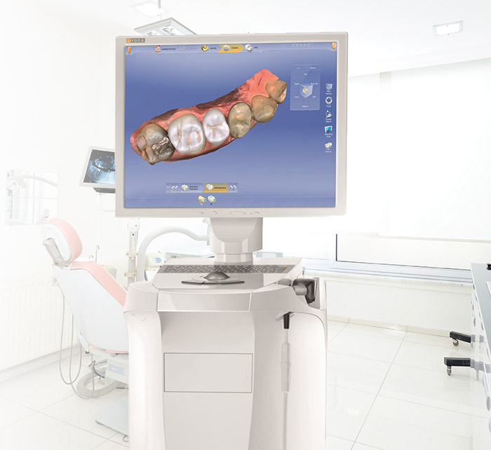 Computer with digital tooth model and CEREC same day dentistry technology